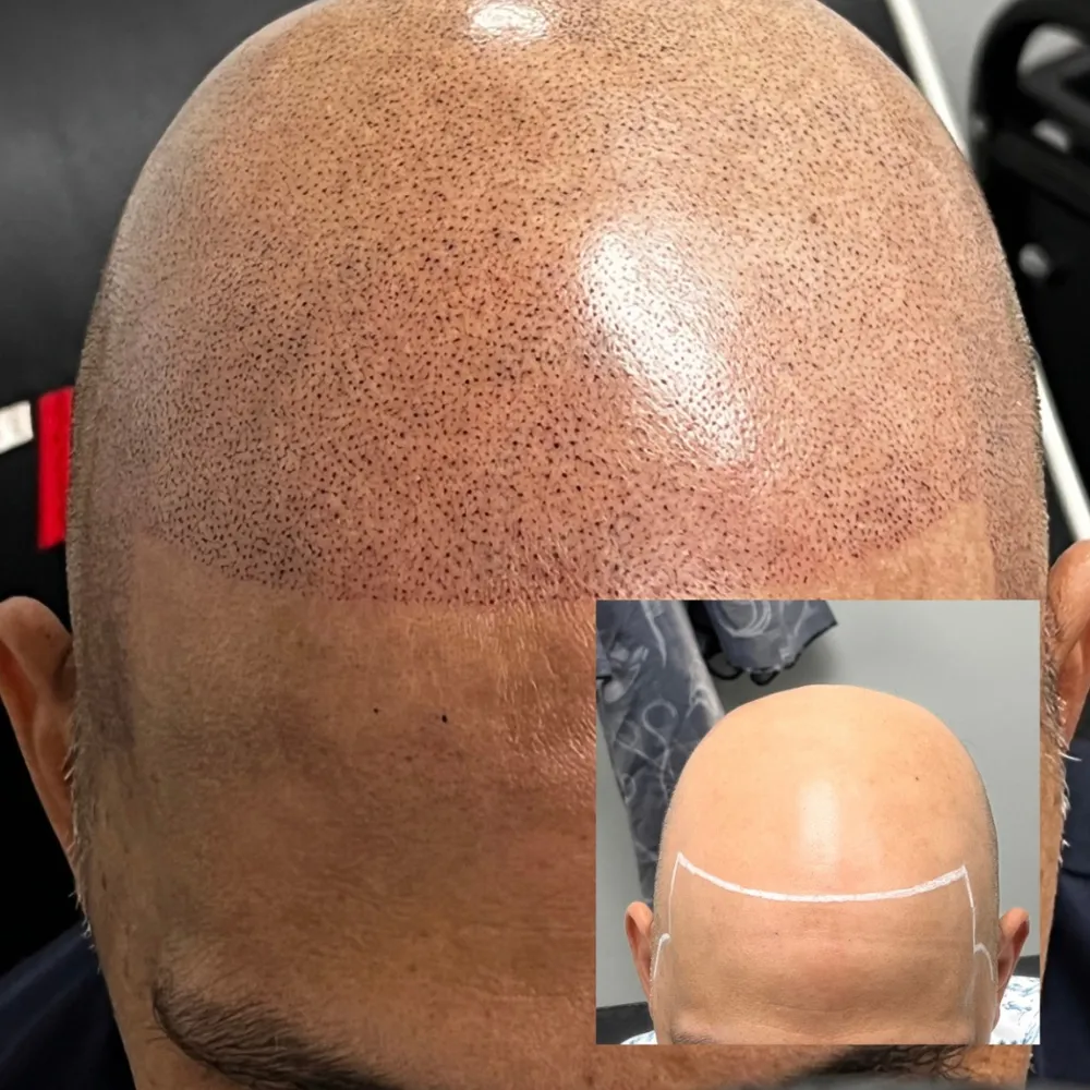 tmp7z2jki__