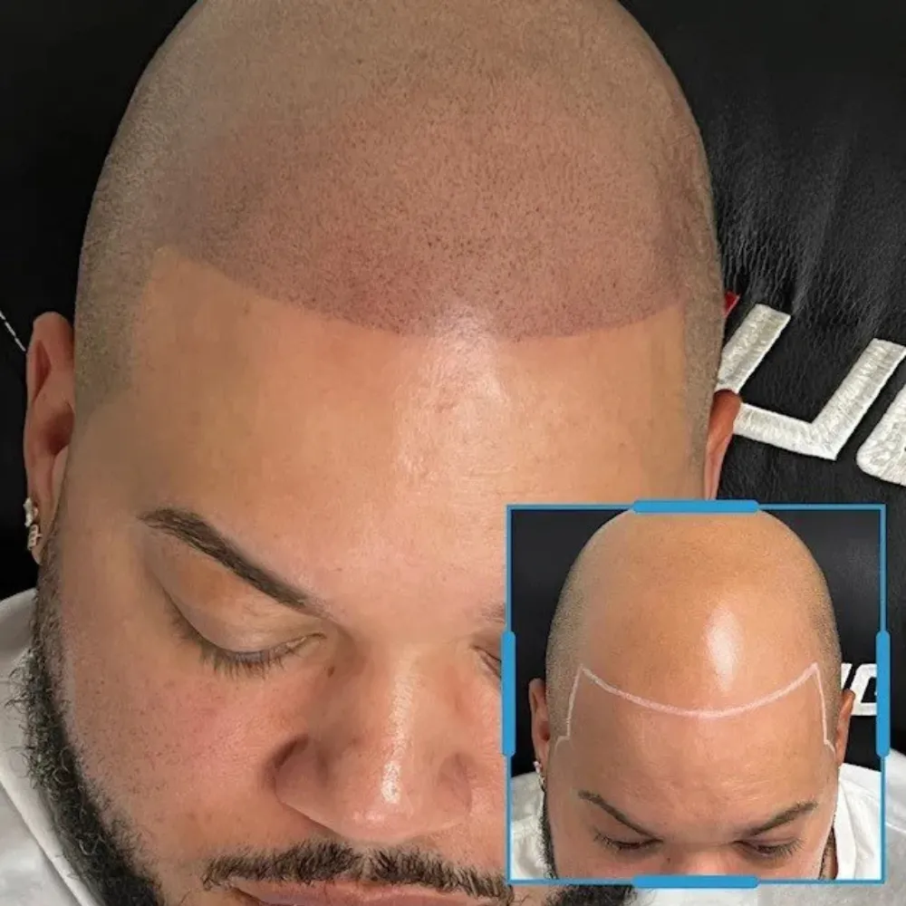 tmpnlzpmeto